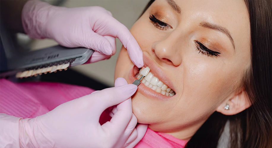 En İyi Diş Kaplaması Hangisi?